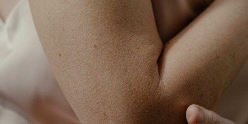 Wat is een tenniselleboog en hoe te behandelen